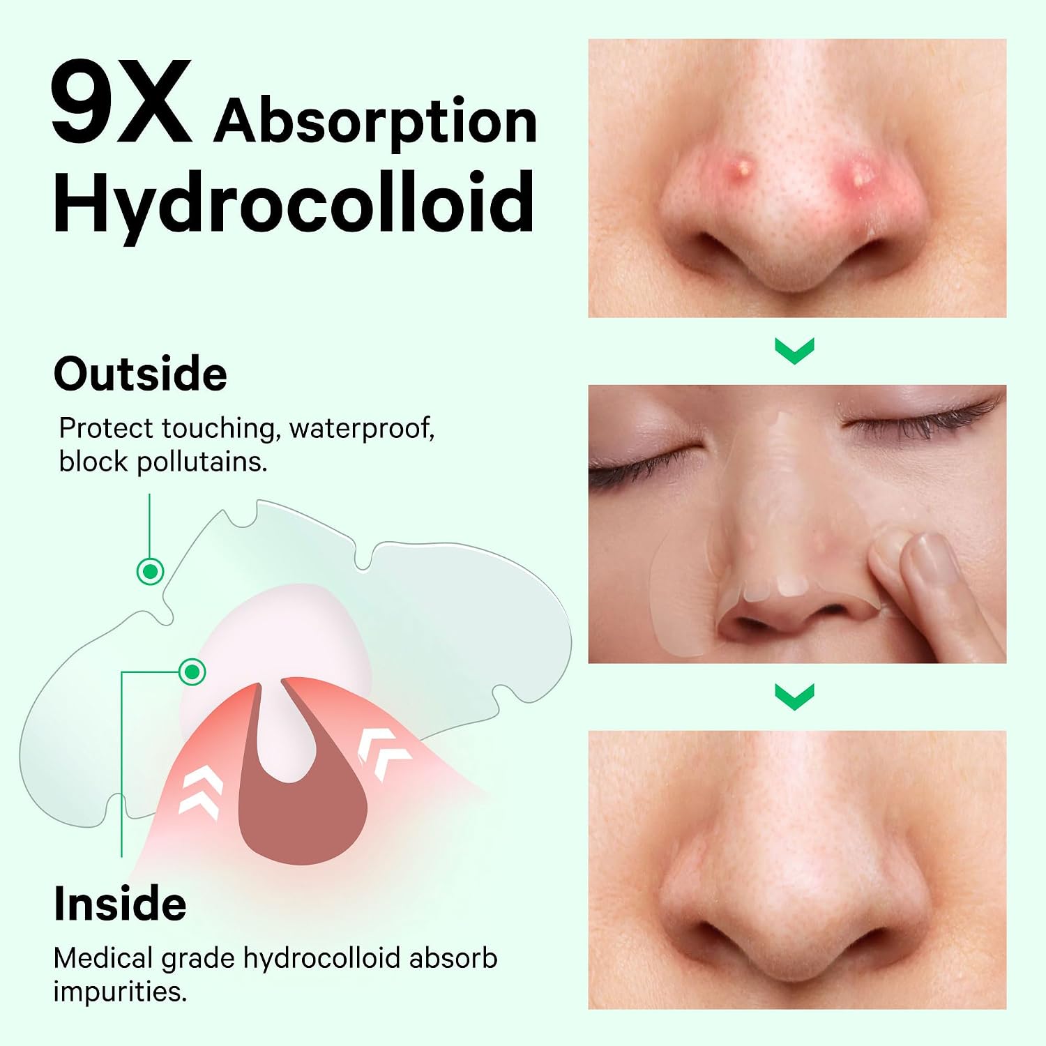 Hydrocolloid Pimple & Pore Patches for Nose, Absorb Oil Overnight, Target Pimples, Zits and Pores, FSA Eligible Acne
