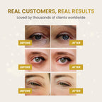 24K Gold Under Eye Patches for Puffy Eyes, Dark Circles 5 Pairs