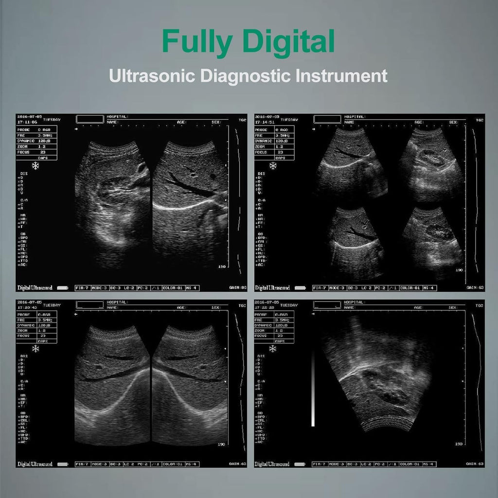 Veterinary Ultrasound Handheld Scanner with 3.5MHz Convex Probes Portable Ultrasound Machine for Pregnancy Animals