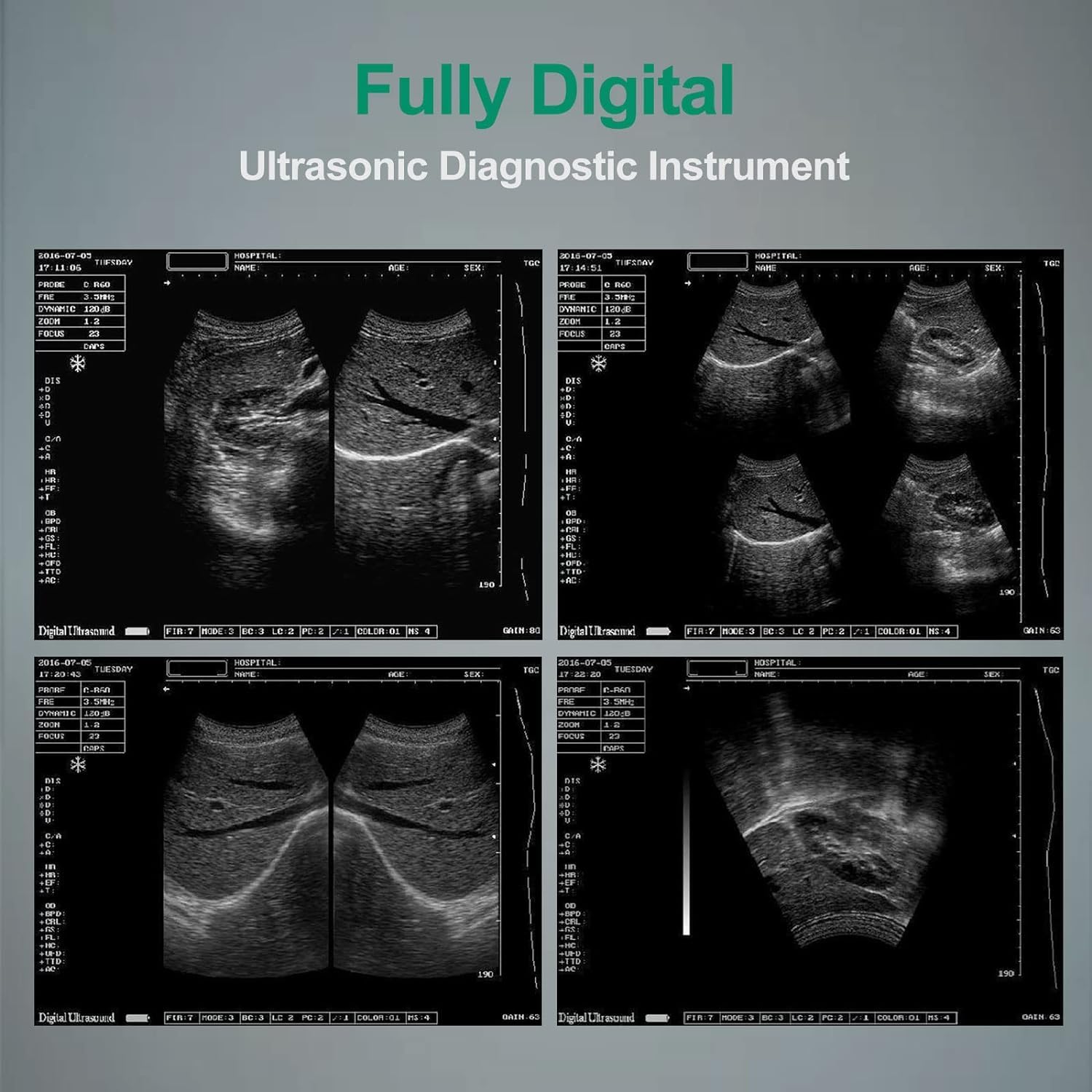 Veterinary Ultrasound Handheld Scanner with 3.5MHz Convex Probes Portable Ultrasound Machine for Pregnancy Animals