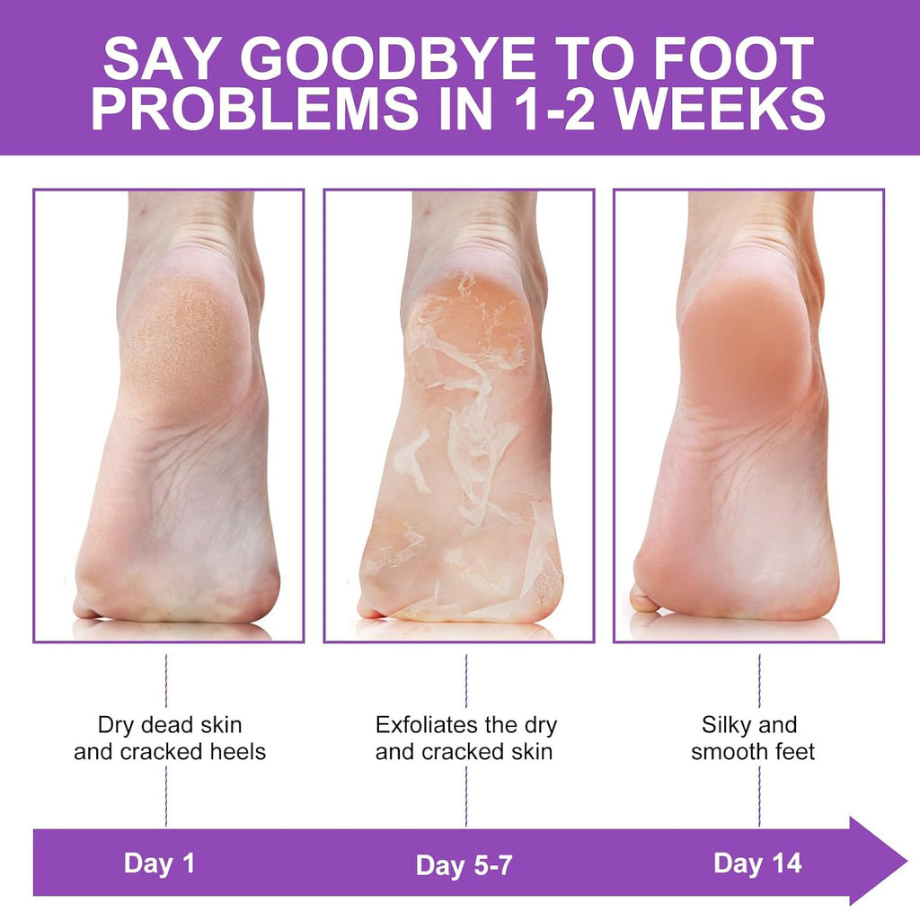 Foot Peeling Mask 5 Pack, Foot Peel Mask Remove Dead Skin, Rough Callus and Cracked Heels, Dry Skin Moisturizer for