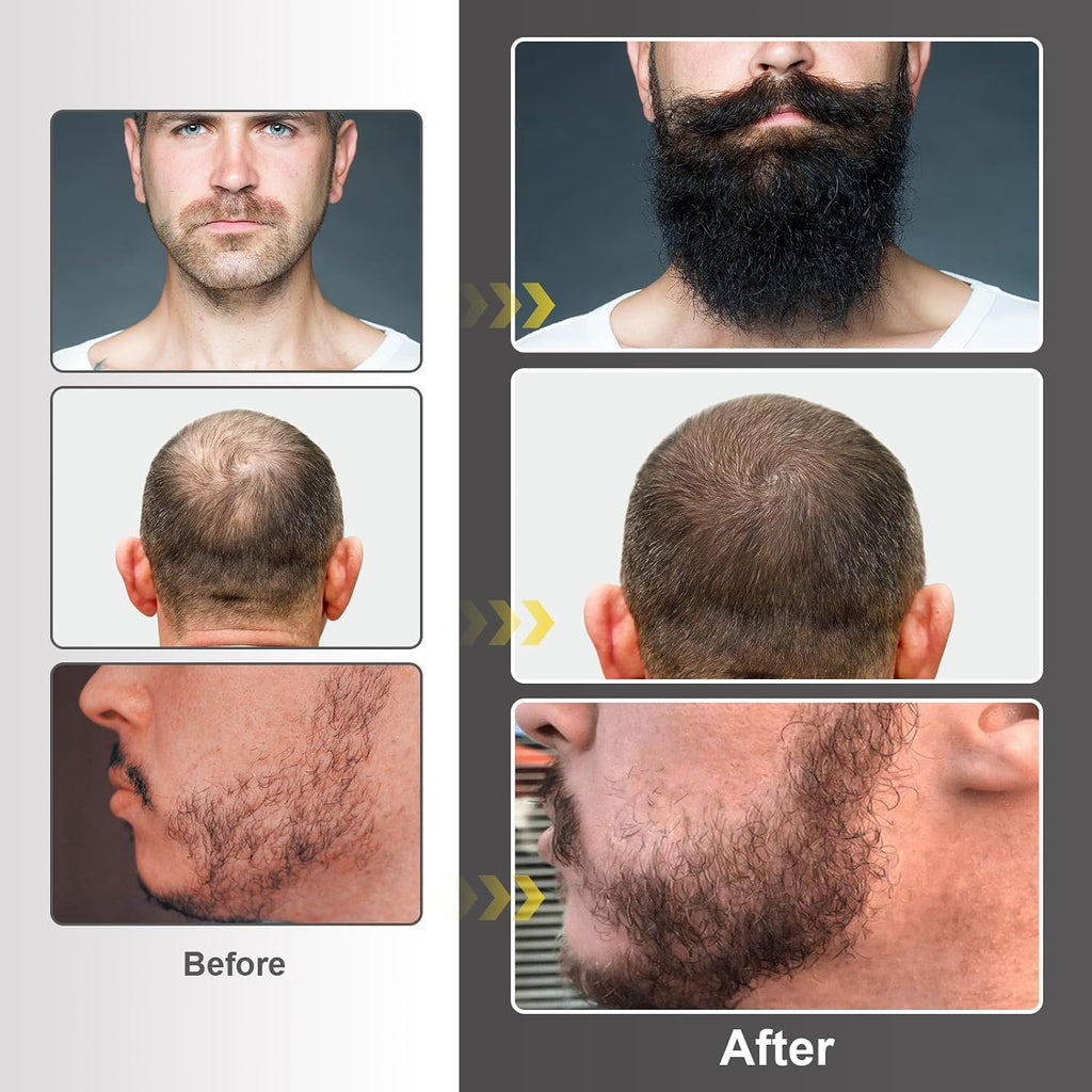Beard Growth Kit - Beard Kit for Men with Beard Growth Oil (2oz), Beard Balm, Beard Comb, Massager for Spot/Patchy