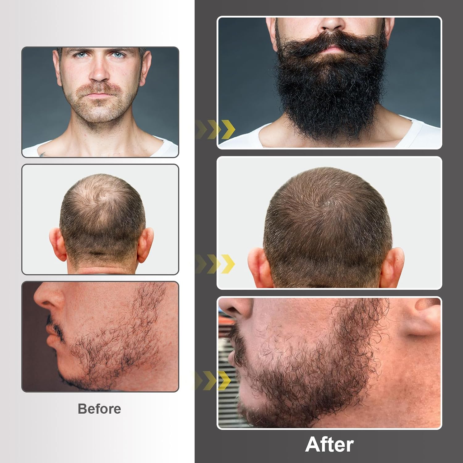 Beard Growth Kit - Beard Kit for Men with Beard Growth Oil (2oz), Beard Balm, Beard Comb, Massager for Spot/Patchy