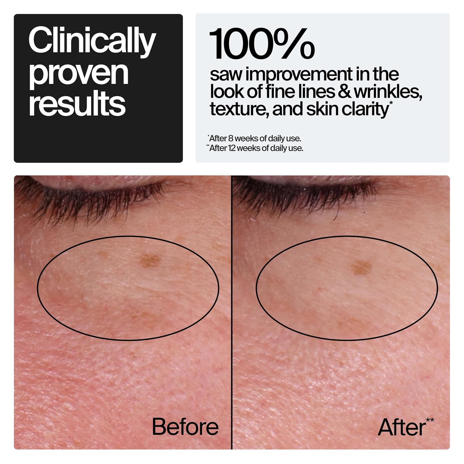 Rapid Wrinkle Repair Retinol Face Moisturizer 1.7 oz