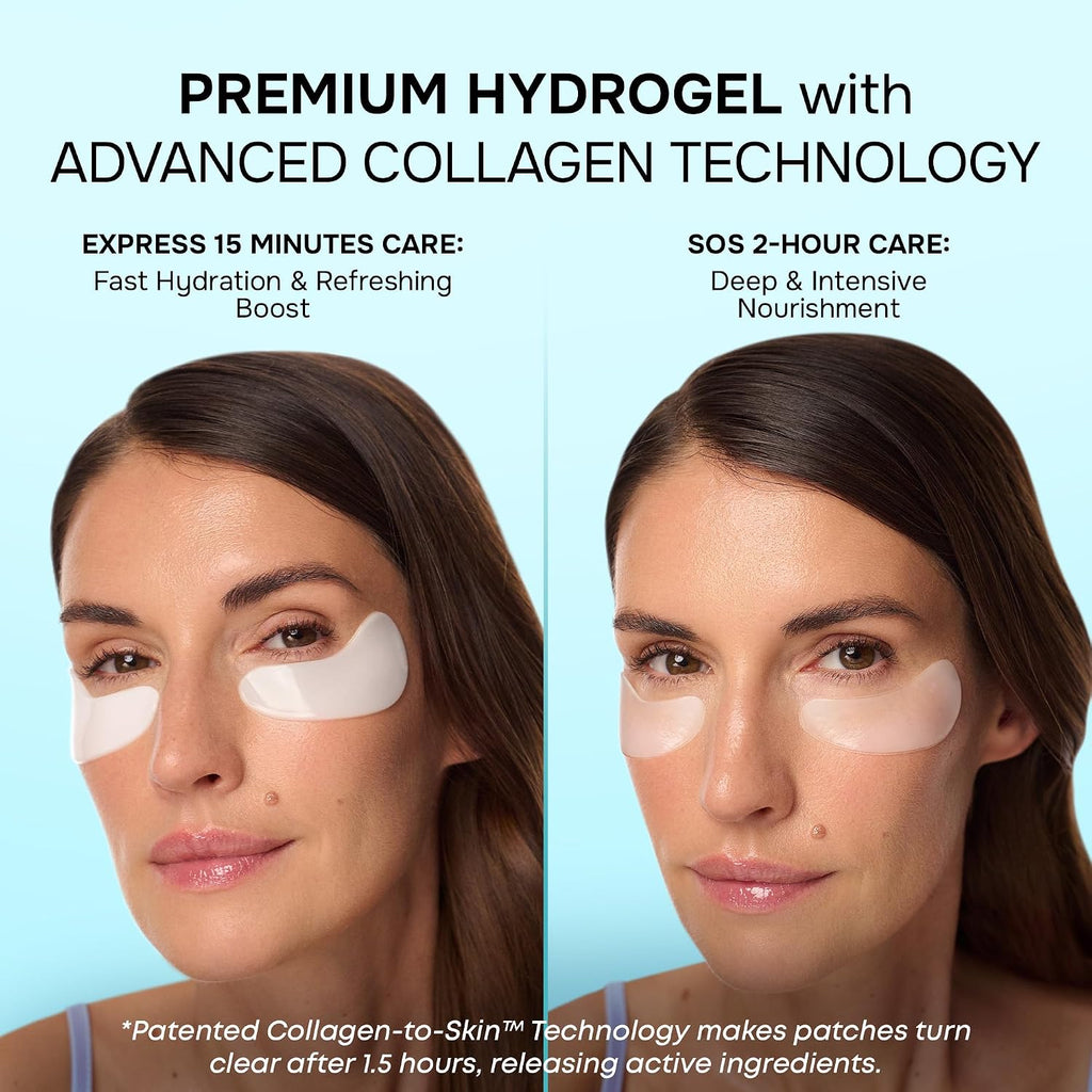 Collagen Eye Patches for Puffy Eyes - Retinol, Hyaluronic Acid, 15 Pairs | Depuffing Under Eye Patches for Dark