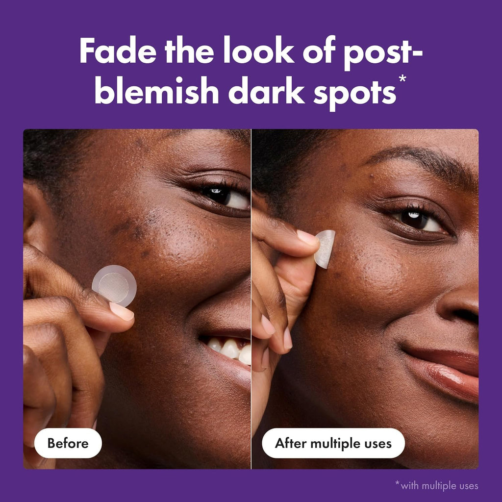 Hero Cosmetics for Dark Spots Post-Blemish Patch, 8 Ct | Acne Patch with 395 Micropoints, Formulated With Vitamin C