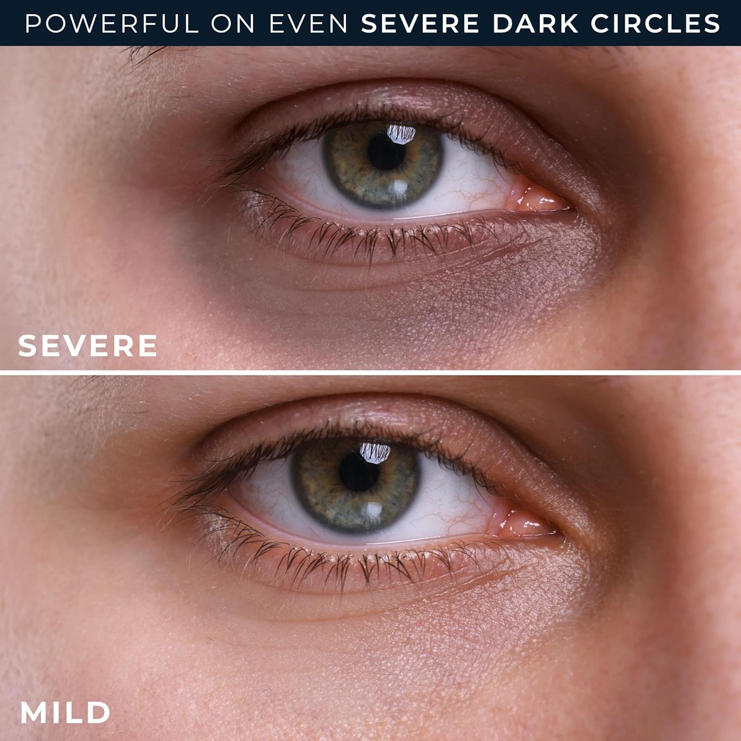 Derm Correxion Retinol Eye Repair Dark Circle Cream Treatment with Niacinamide, Resveratrol, Proxygen for Puffy Eyes