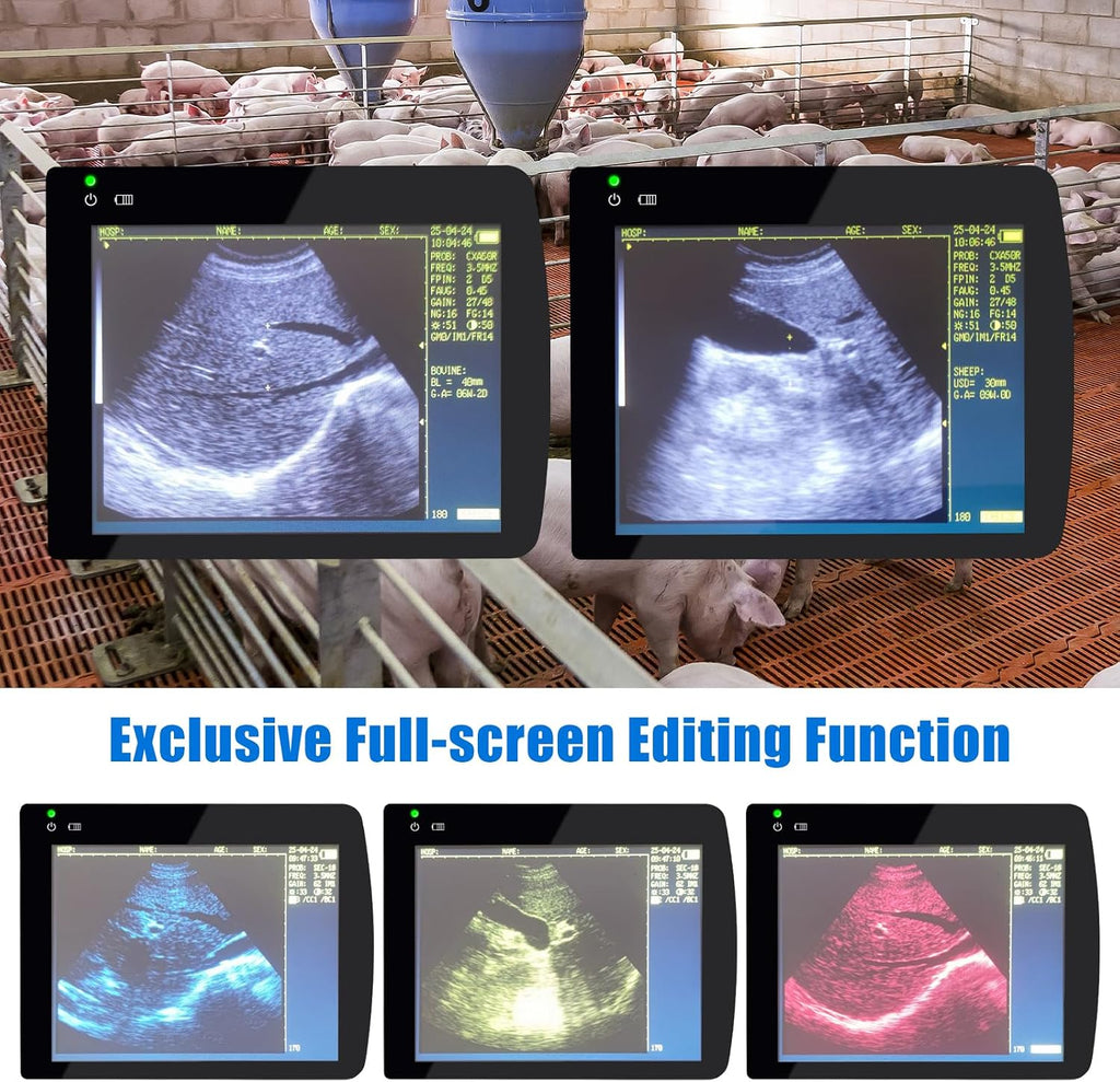 Portable Ultrasound Machine for Pregnancy - with Convex Probe & 5 Imaging Modes, Pregnancy Digital Ultrasound Machine