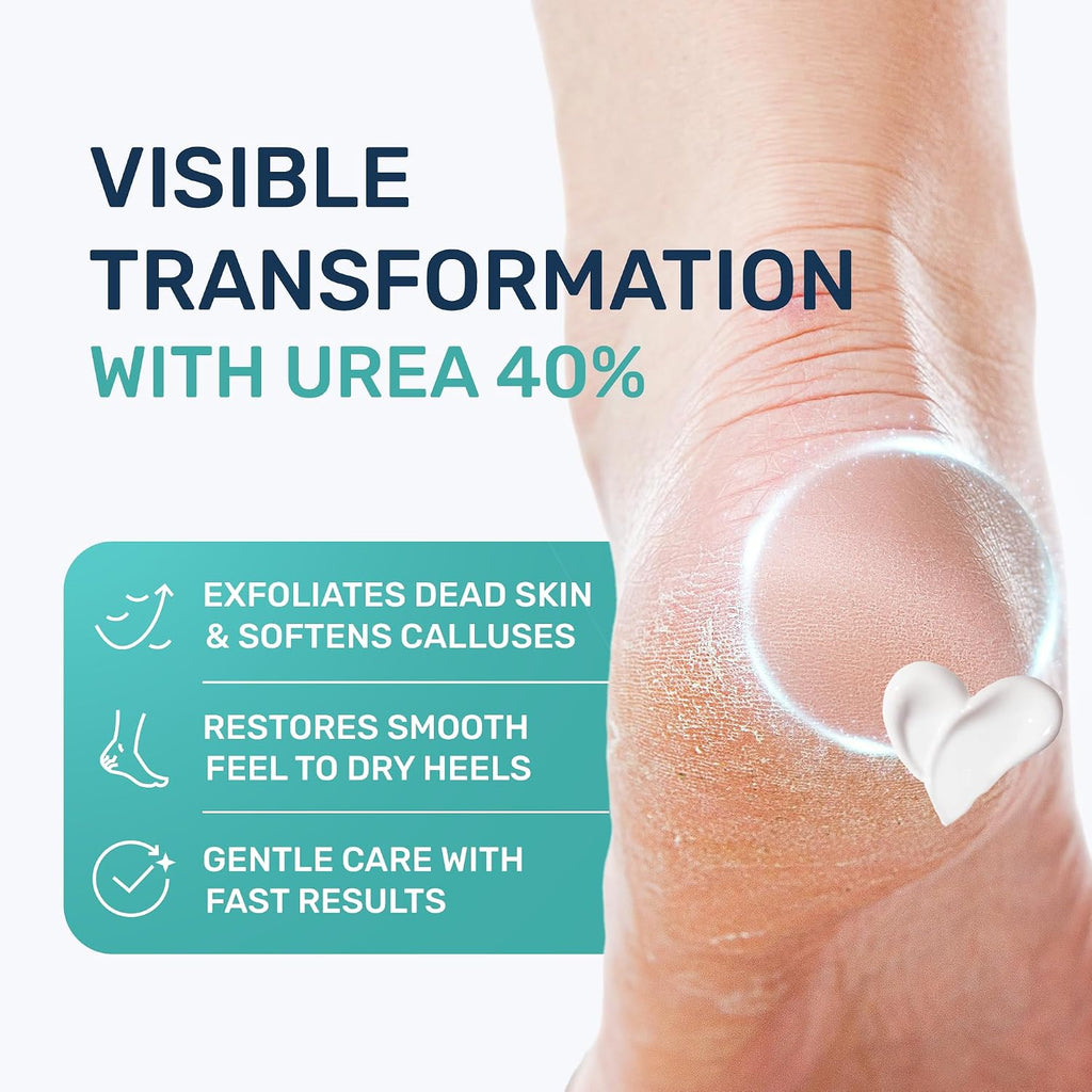 Urea Cream 40 Percent for Feet Maximum Strength - Urea Foot Cream and Callus Remover, Exfoliating Heels Cream with
