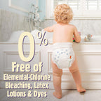 Skin Smart, Absorbent & Hypoallergenic Diapers with Flexible & Secure Tabs | Bulk Case | Size 2 | 200 Count
