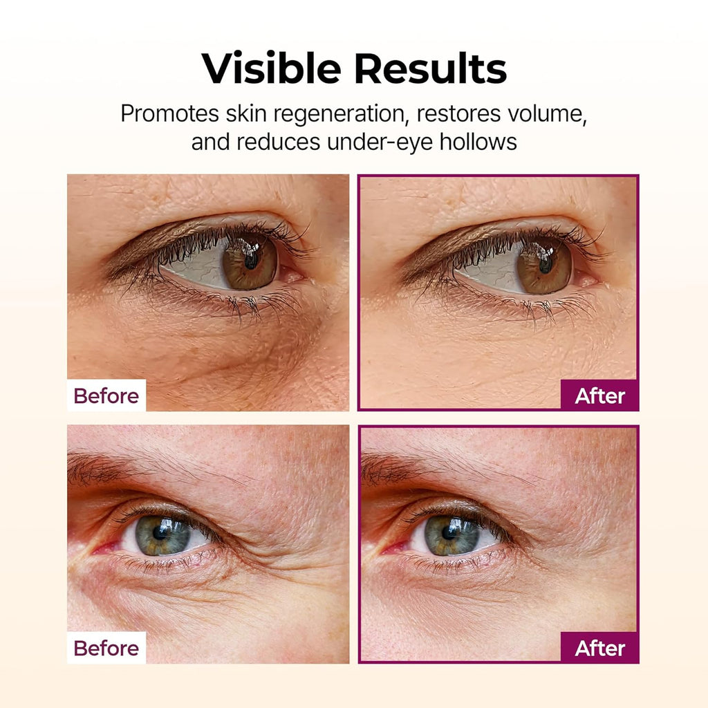 Collagen Multi Balm Stick, Calcium & Adenosine Korean Wrinkle Stick for Eye, Neck & Face, Firming Collagen Stick
