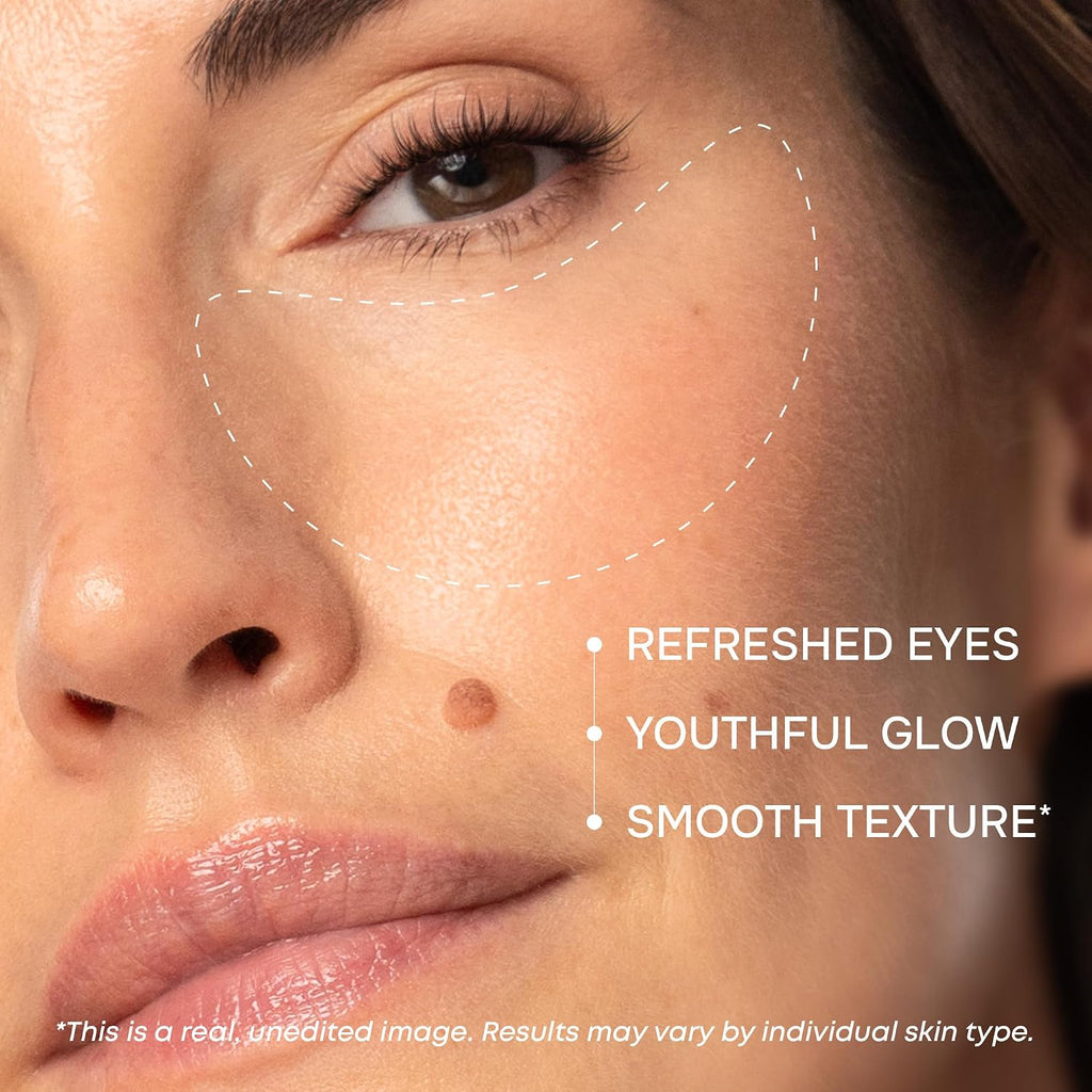 Collagen Eye Patches for Puffy Eyes - Retinol, Hyaluronic Acid, 15 Pairs | Depuffing Under Eye Patches for Dark