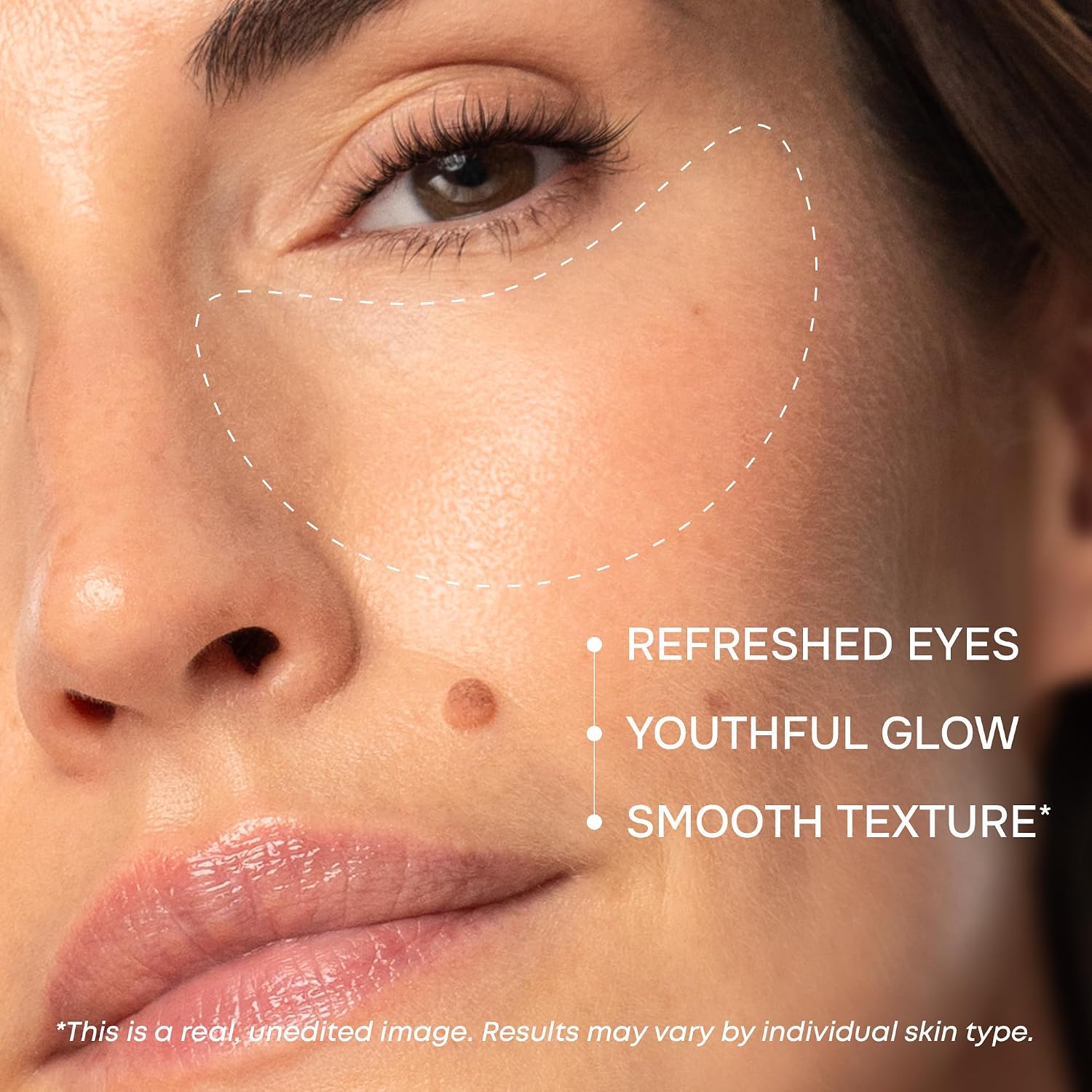 Collagen Eye Patches for Puffy Eyes - Retinol, Hyaluronic Acid, 15 Pairs | Depuffing Under Eye Patches for Dark