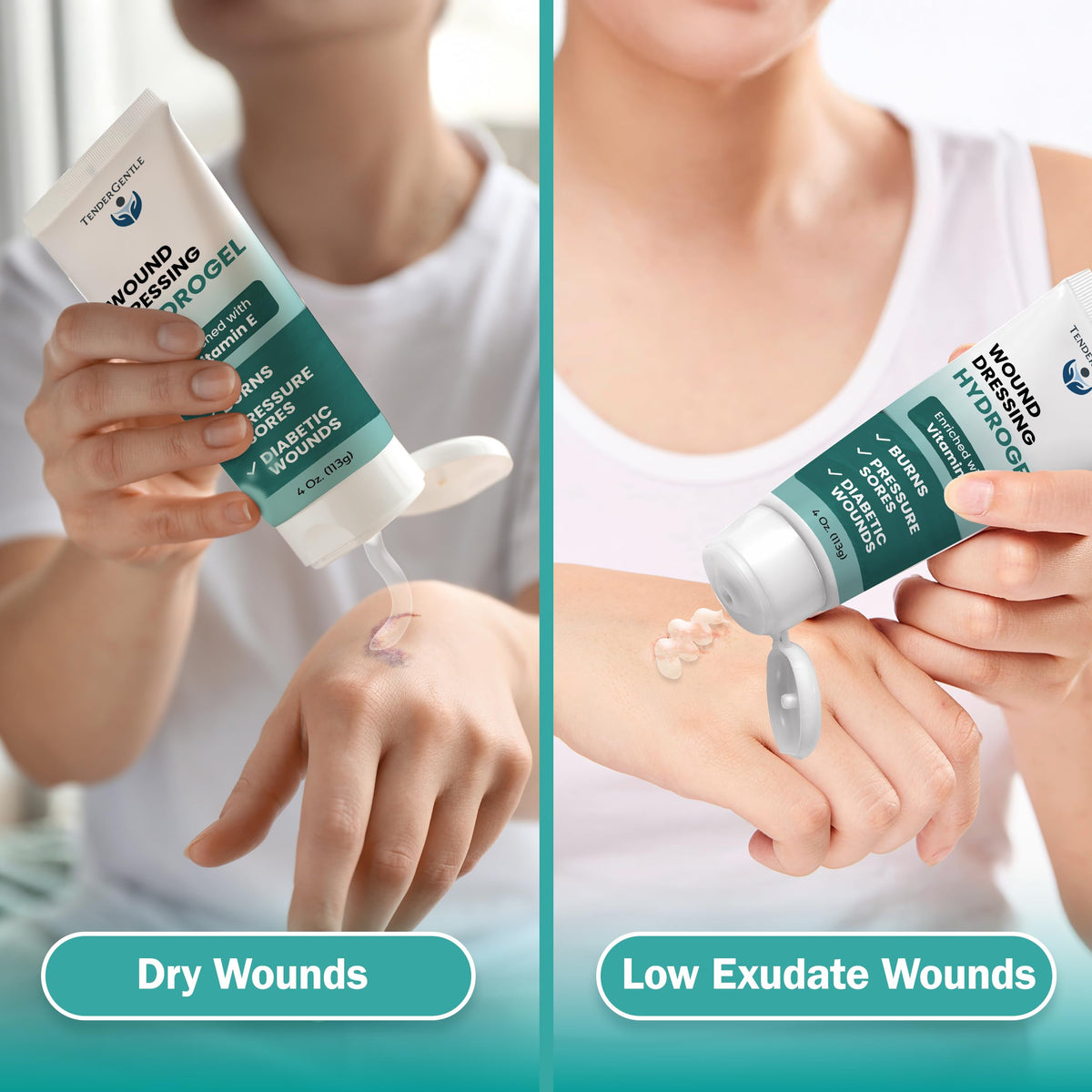 Hydrogel Wound Dressing Ointment - 4 oz Amorphous Hydrogel for Wound Care, Burns, Diabetic Ulcers - Enriched with