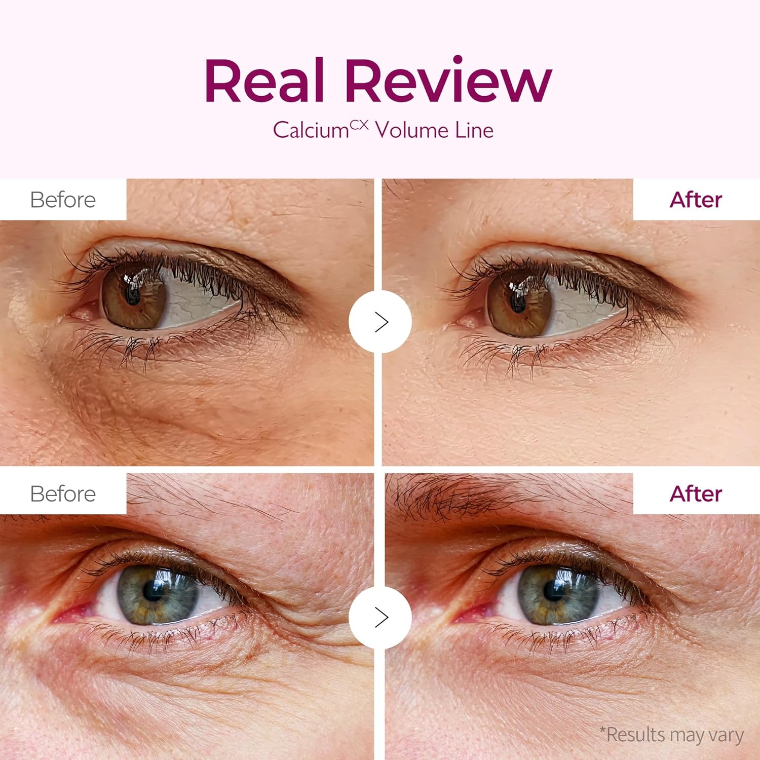 Calcium Volume Under Eye Patches for Puffy Eyes & Dark Circles, Hydrogel Eye Mask for Wrinkles, Fine Lines & Sagging