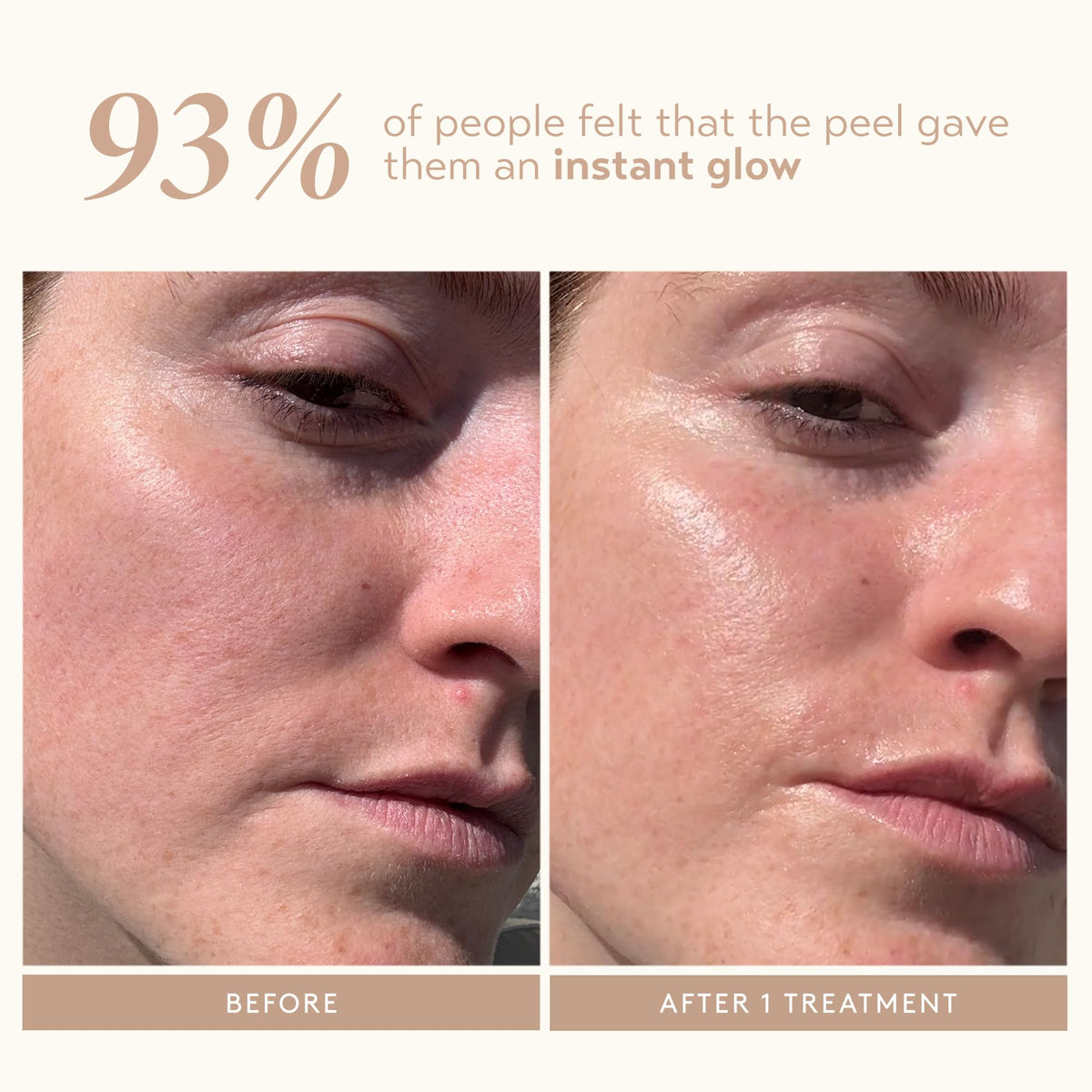 Skincare Triple Acid Peel, 2-Step Exfoliating Face Peel