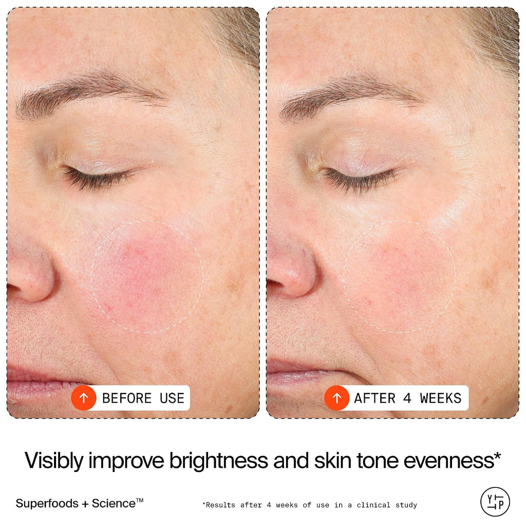 15% Vitamin C Bright Cell Face Serum (1 fl oz) | Brightening Facial Serum for Even Tone - Niacinamide + Adenosine +