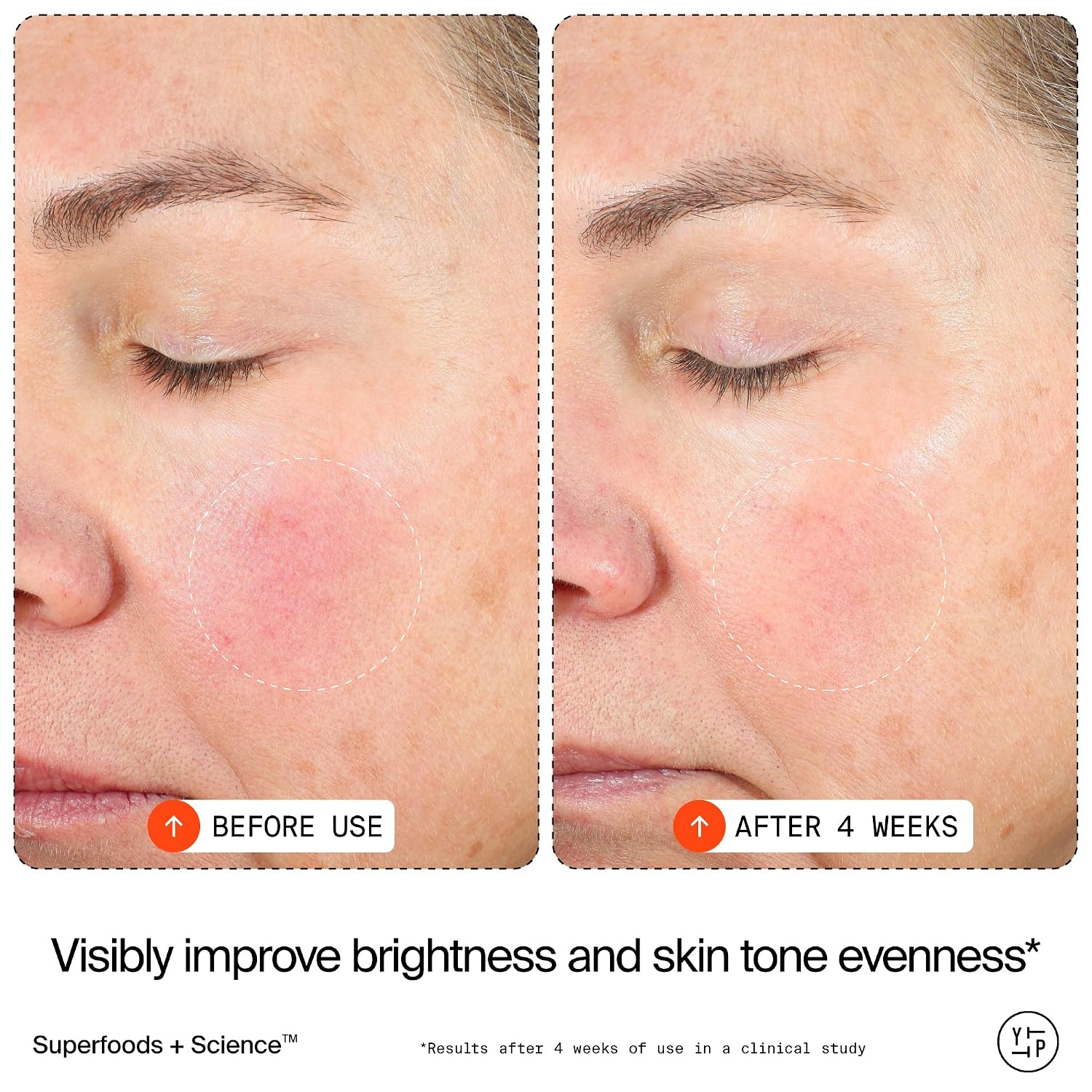 15% Vitamin C Bright Cell Face Serum (1 fl oz) | Brightening Facial Serum for Even Tone - Niacinamide + Adenosine +