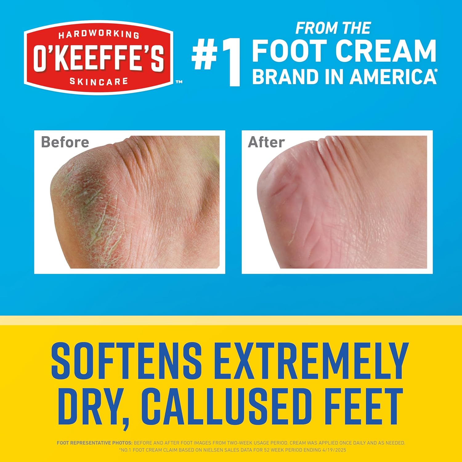 Healthy Feet Intense Renewal Cream, 3 oz Tube, 1-Pack | Chemically Exfoliates & Softens Extremely Callused Dry Feet