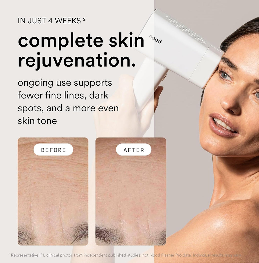 Flasher Pro | IPL Laser Hair Removal Device, Forbes Best Product 2026 | Clinical-Grade Permanent Results At Home