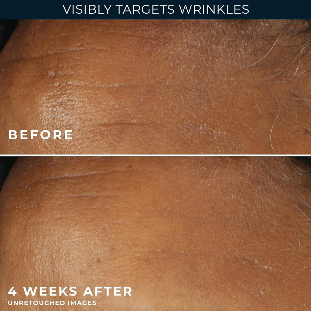 Retinol Correxion Deep Wrinkle Daily Face Moisturizer with Sunscreen SPF 30 for Fine Lines, Dark Spots, Post-Acne