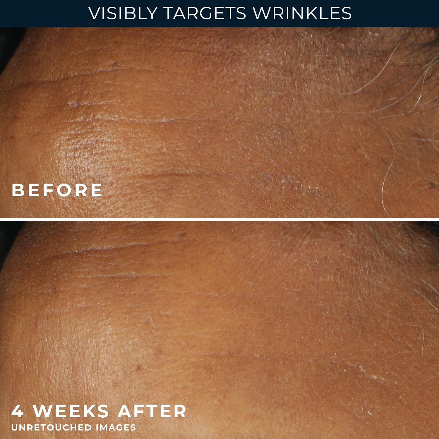 Retinol Correxion Deep Wrinkle Daily Face Moisturizer with Sunscreen SPF 30 for Fine Lines, Dark Spots, Post-Acne