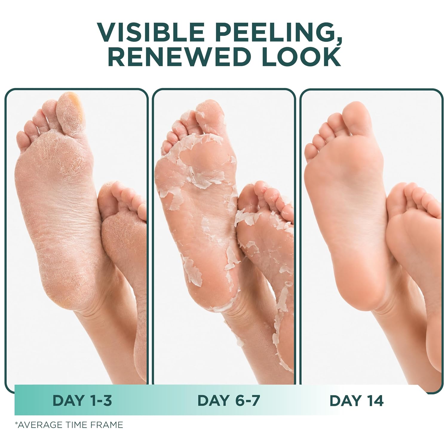 Foot Peel Mask, Exfoliating Foot Peeling Mask, 2 Pairs, Original | Dry and Cracked Feet, At-Home Spa Care, Callus