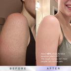 KP Bump Eraser Body Scrub, 10% AHAs + PHAs, Rough & Bumpy Skin