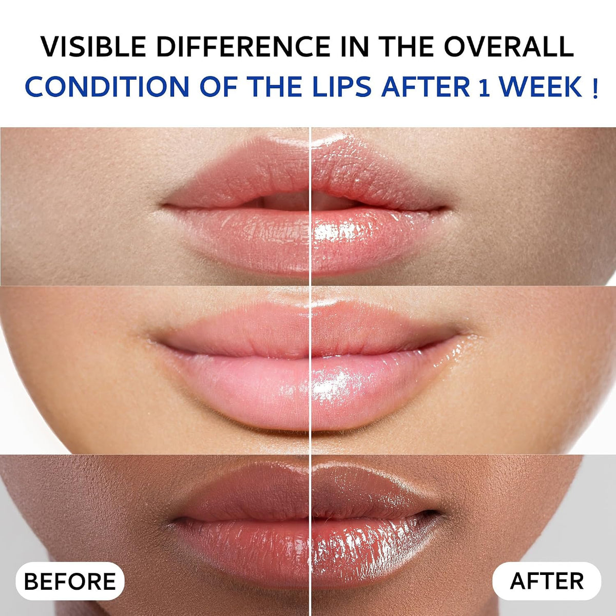 Lip Sleeping Mask (20g), Collagen Lip Mask Overnight, Lip Plumper with Hyaluronic Acid, Peptide Complex Lip Balm for
