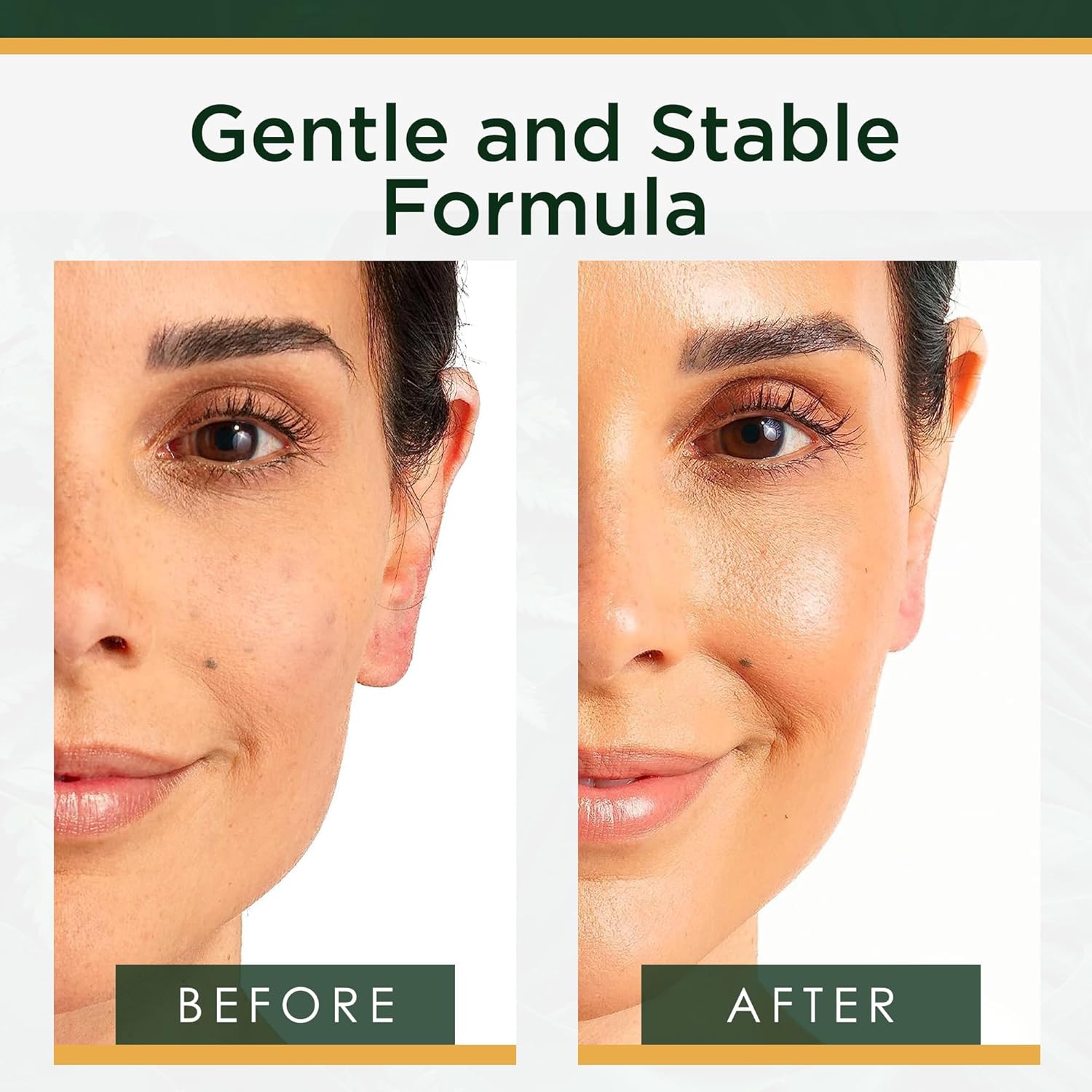 Vitamin C Serum for Face - Brightening and Hydrating Face Oil for Dark Spots and Fine Lines - Suitable for Sensitive