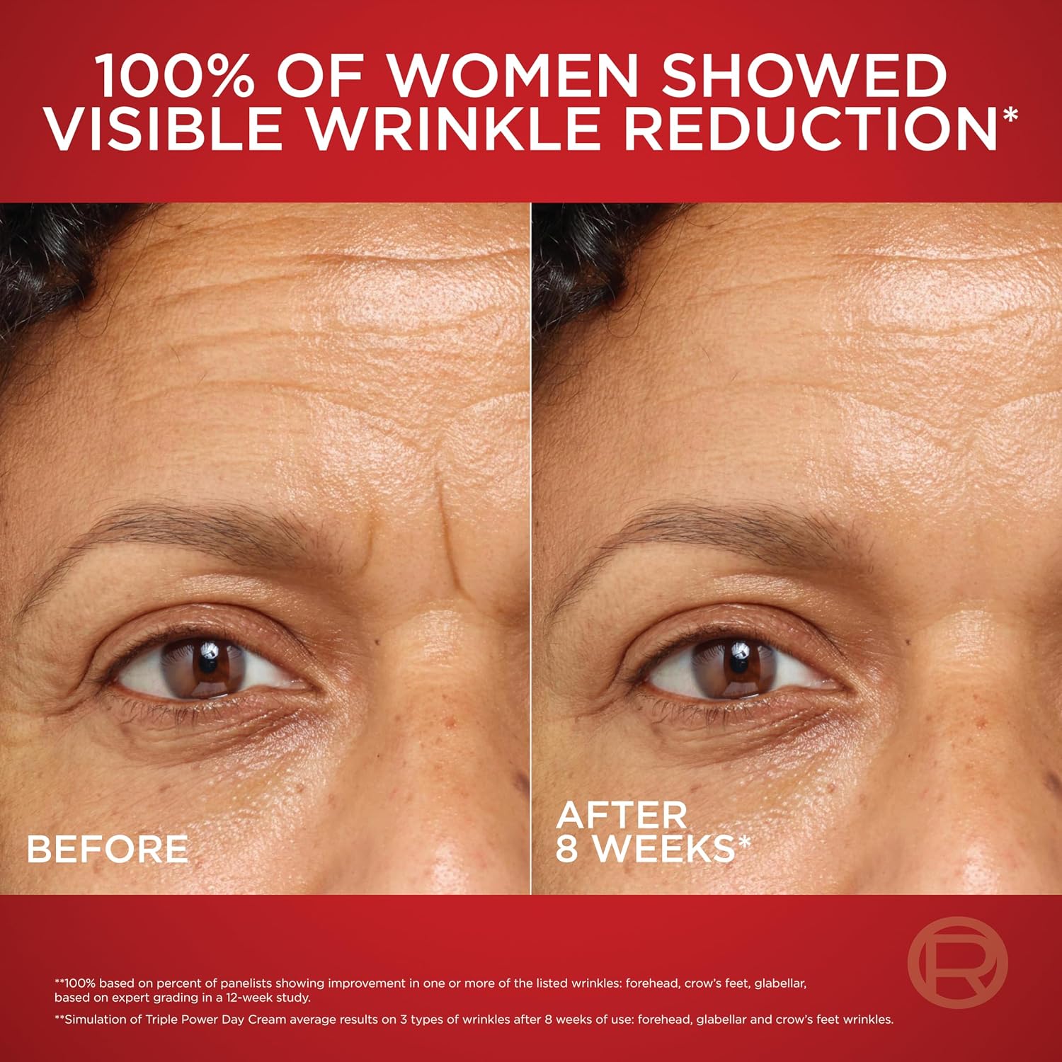 Revitalift Triple Power Anti-Aging Face Moisturizer, Pro Retinol, Hyaluronic Acid & Vitamin C to Reduce Wrinkles