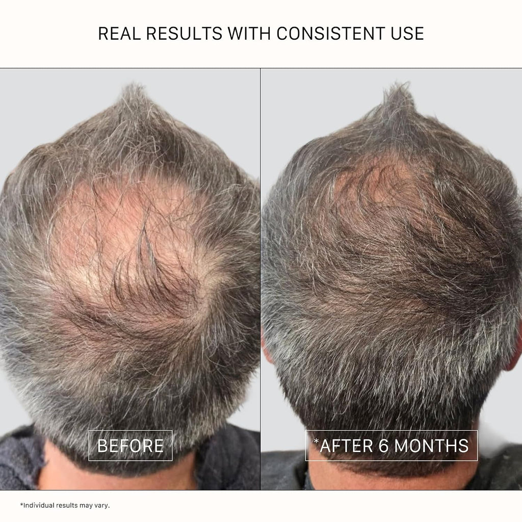 Recover Thickening Conditioner (Unisex) | Supports Optimal Hair Care and Recovery, Strengthens & Hydrates, Promotes