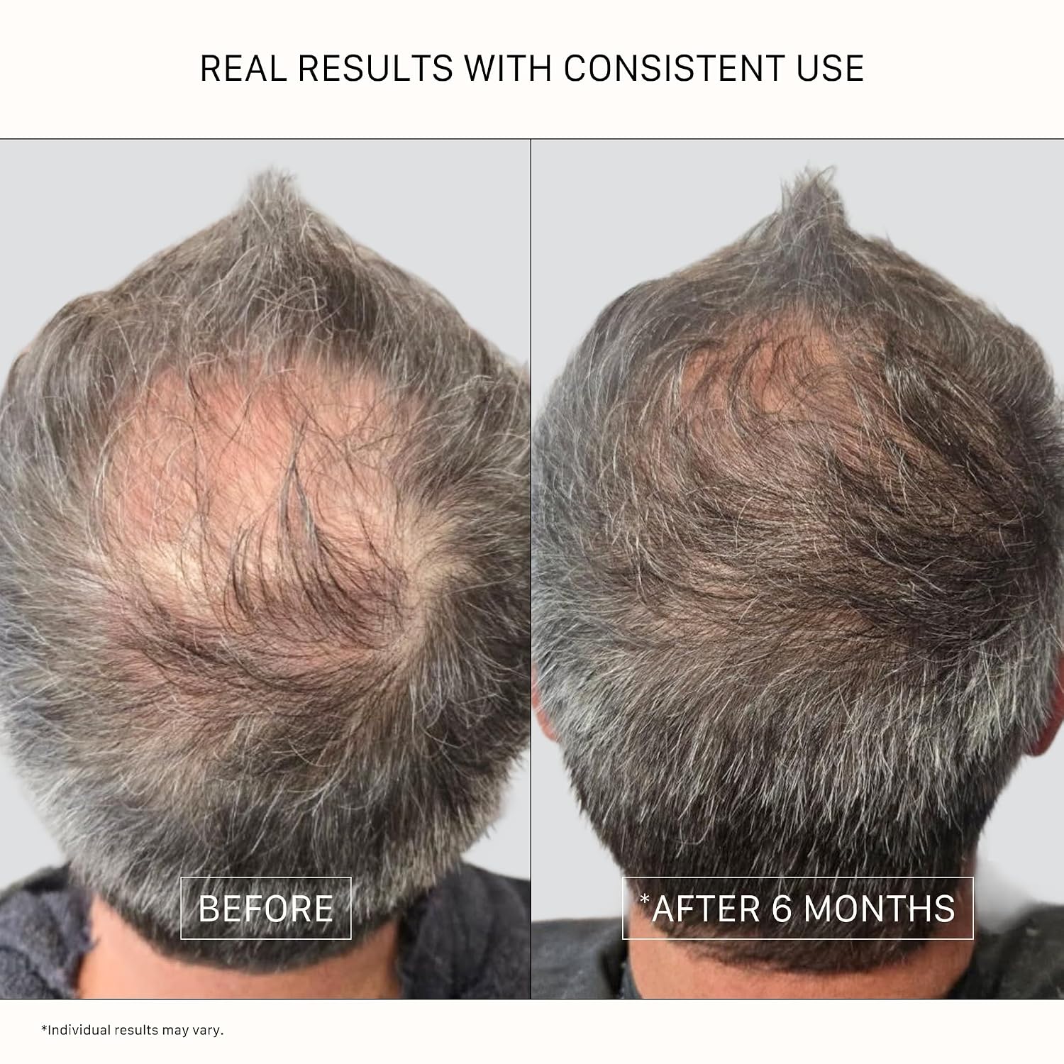 Recover Thickening Conditioner (Unisex) | Supports Optimal Hair Care and Recovery, Strengthens & Hydrates, Promotes
