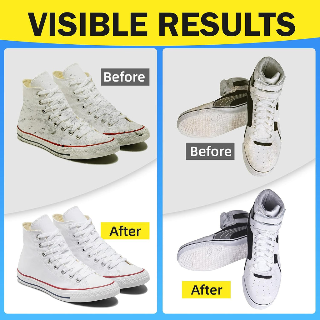 Shoe Cleaner Kit – Foam Cleaner for White Shoes & Sneakers, 6.76 fl oz | Fast Dirt And Stain Removal, Anti-Yellowing