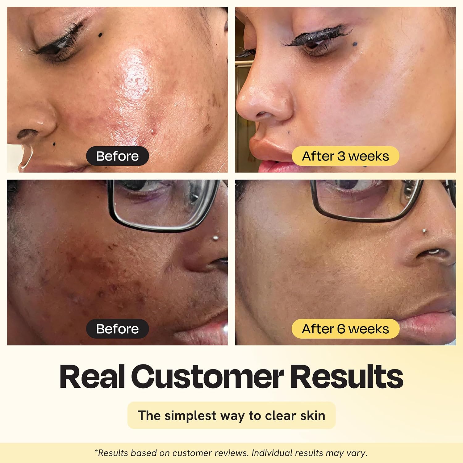 Vitamin C Clay Mask for Dark Spots 2.5oz Brightening Clay Face Mask | with Turmeric, Deep Cleansing, Pore Refining