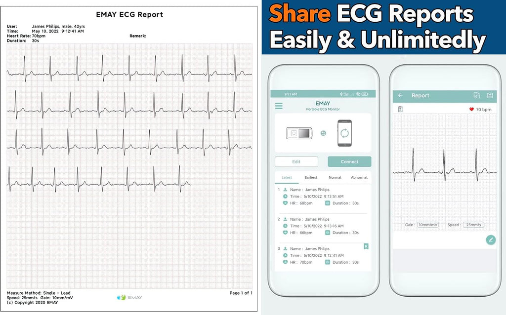 Portable ECG Monitor | Record ECG and Heart Rate | Compatible with Smartphone and PC