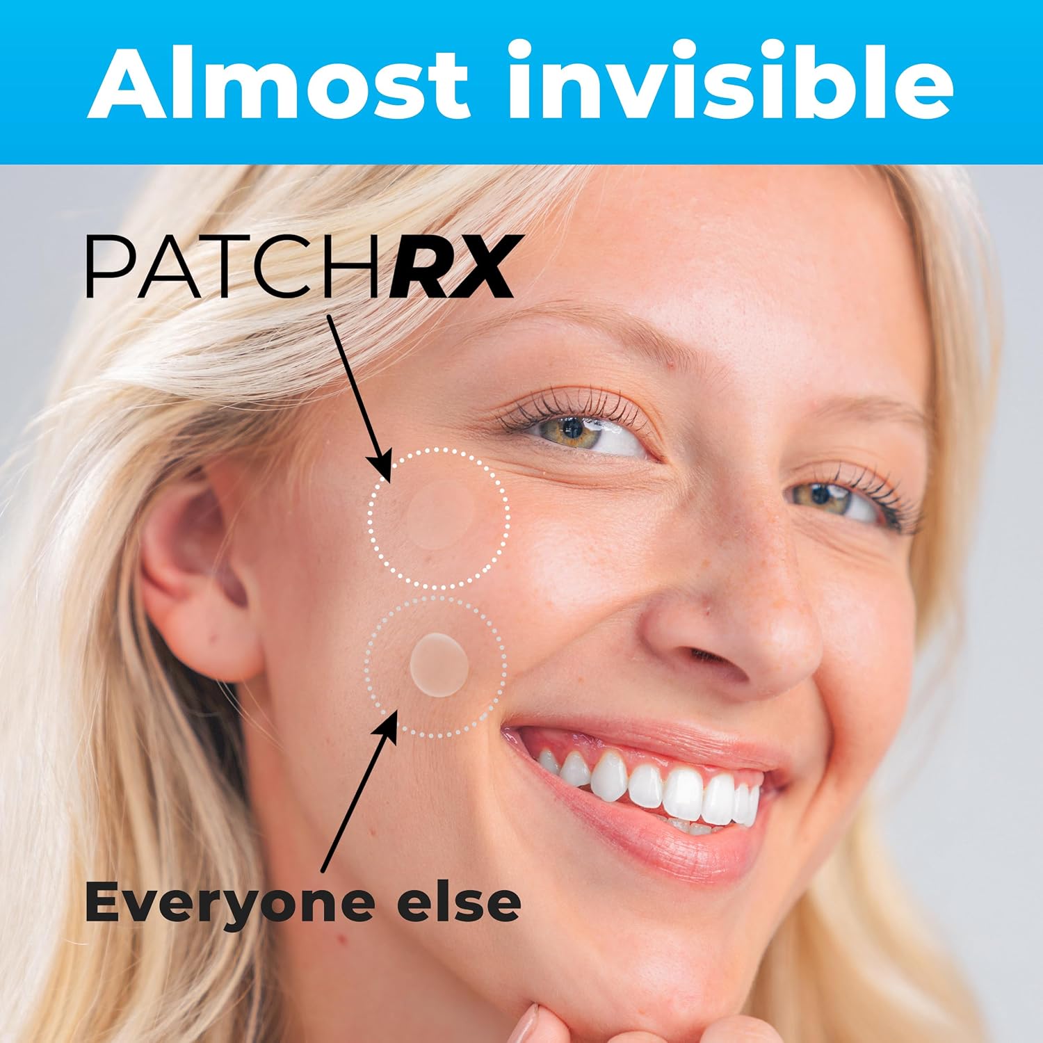 Pimple Patches for Face (120 Patches), Hydrocolloid Acne Patches with Tea Tree Oil, Pimple Patch Pimple Stickers