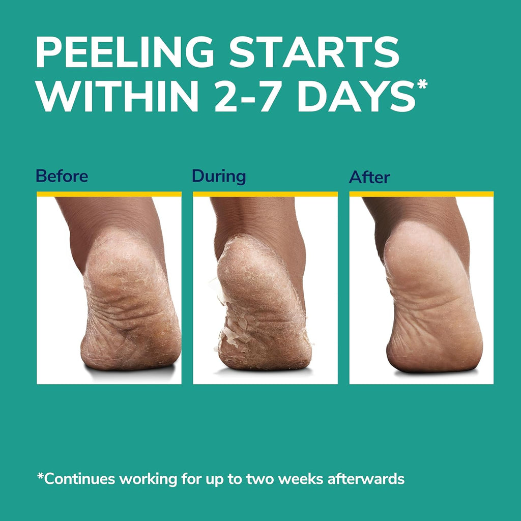 Rough, Dry Skin Ultra Exfoliating Foot Peeling Mask, 3 Pairs Moisturizing Socks Gently Peels and Softens, with Urea