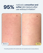 REMEDY KP Exfoliating Body Scrub, with Fine Sugar