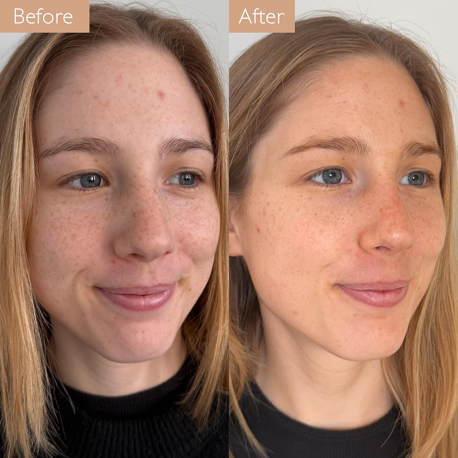 Self-Tan Hydrating Face Drops - 15 mL | Buildable self-tan liquid that mixes into any moisturizer or serum for a