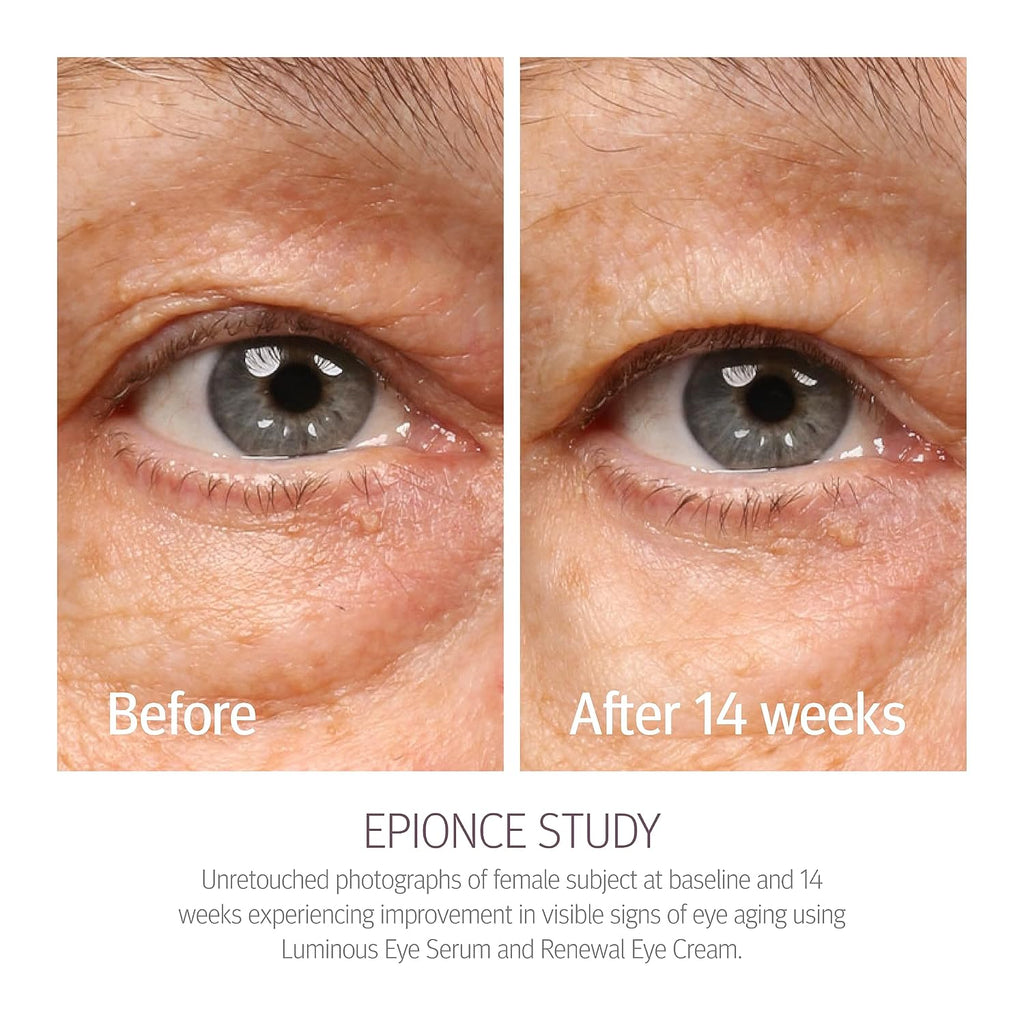 Renewal Eye Cream Anti-Aging Under Eye Cream Dark Circles Puffiness