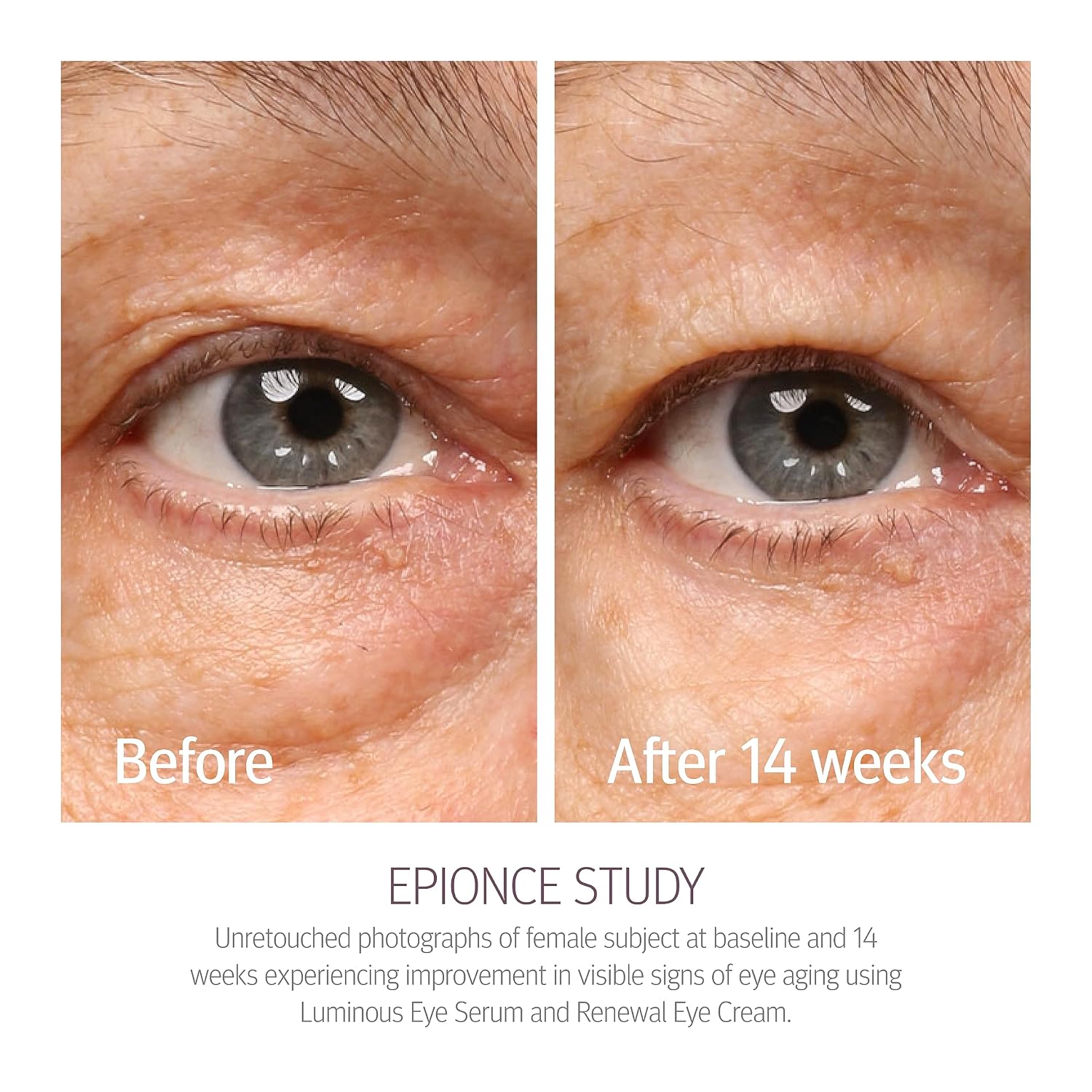 Renewal Eye Cream Anti-Aging Under Eye Cream Dark Circles Puffiness