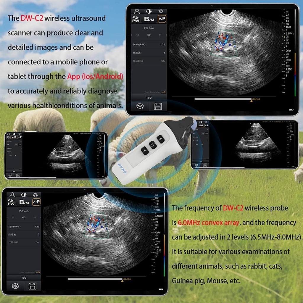 Wireless Color Doppler Ultrasound Machine 6.0MHZ Micro-Convex Probe, Wireless Ultrasound Machine for Android and iOS