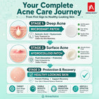 Acne Patch Kit with Microdart & Hydrocolloid, 368 Count