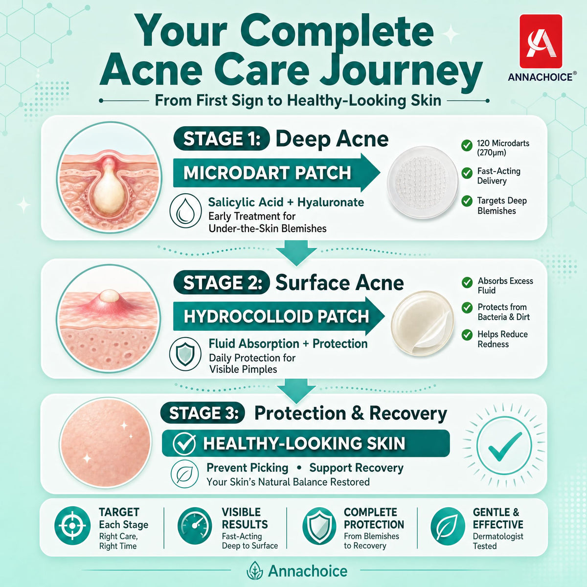 Acne Patch Kit with Microdart & Hydrocolloid, 368 Count