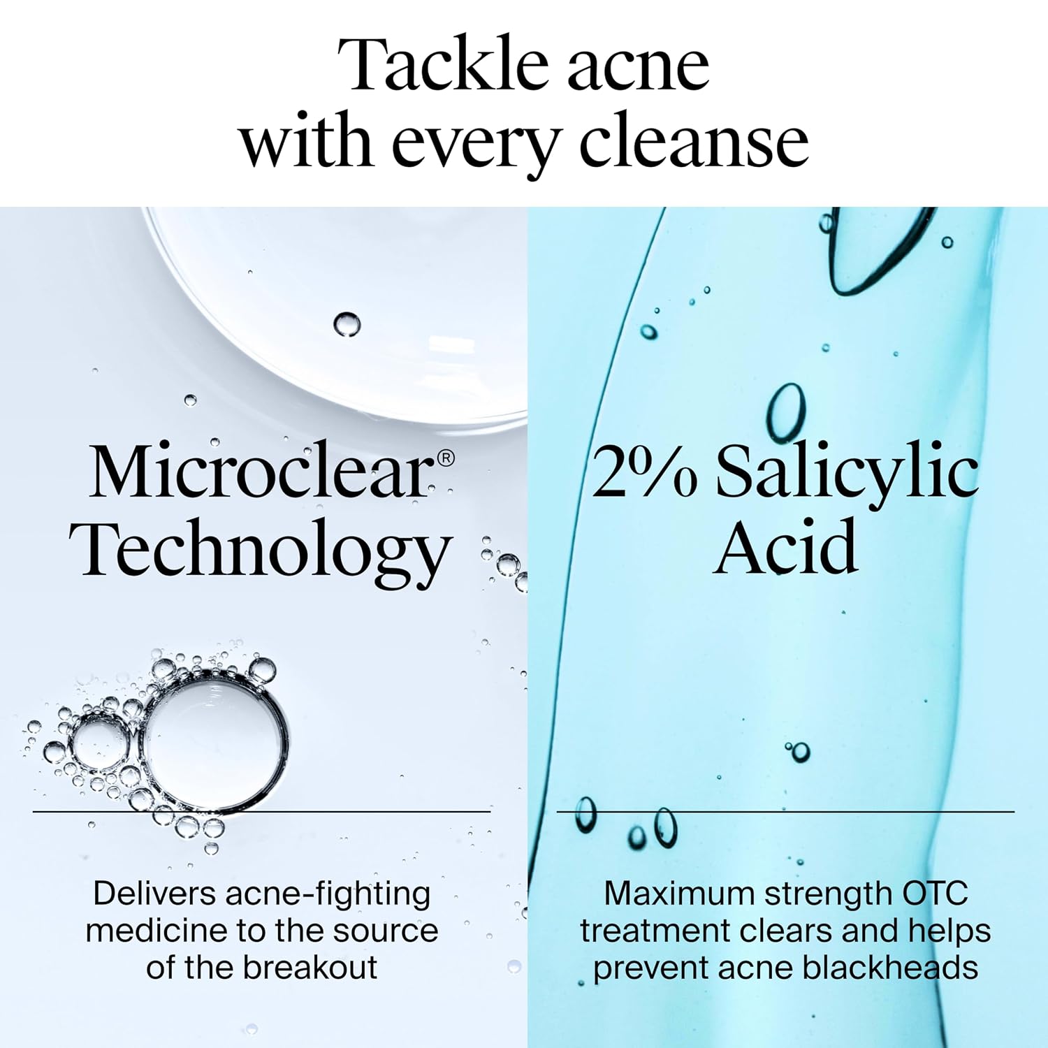 Oil-Free Acne Face Wash - Facial Cleanser with Salicylic Acid, Daily Cleanser for Oily & Acne-Prone Skin, Clears &
