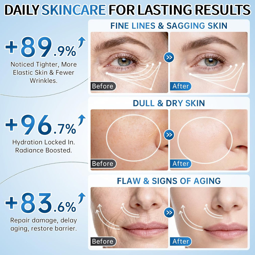 Collagen Skincare Set for Women – 7Pcs Face Care Kit with Cleanser,Toner,Serum,Eye Cream,Face Cream & Masks –