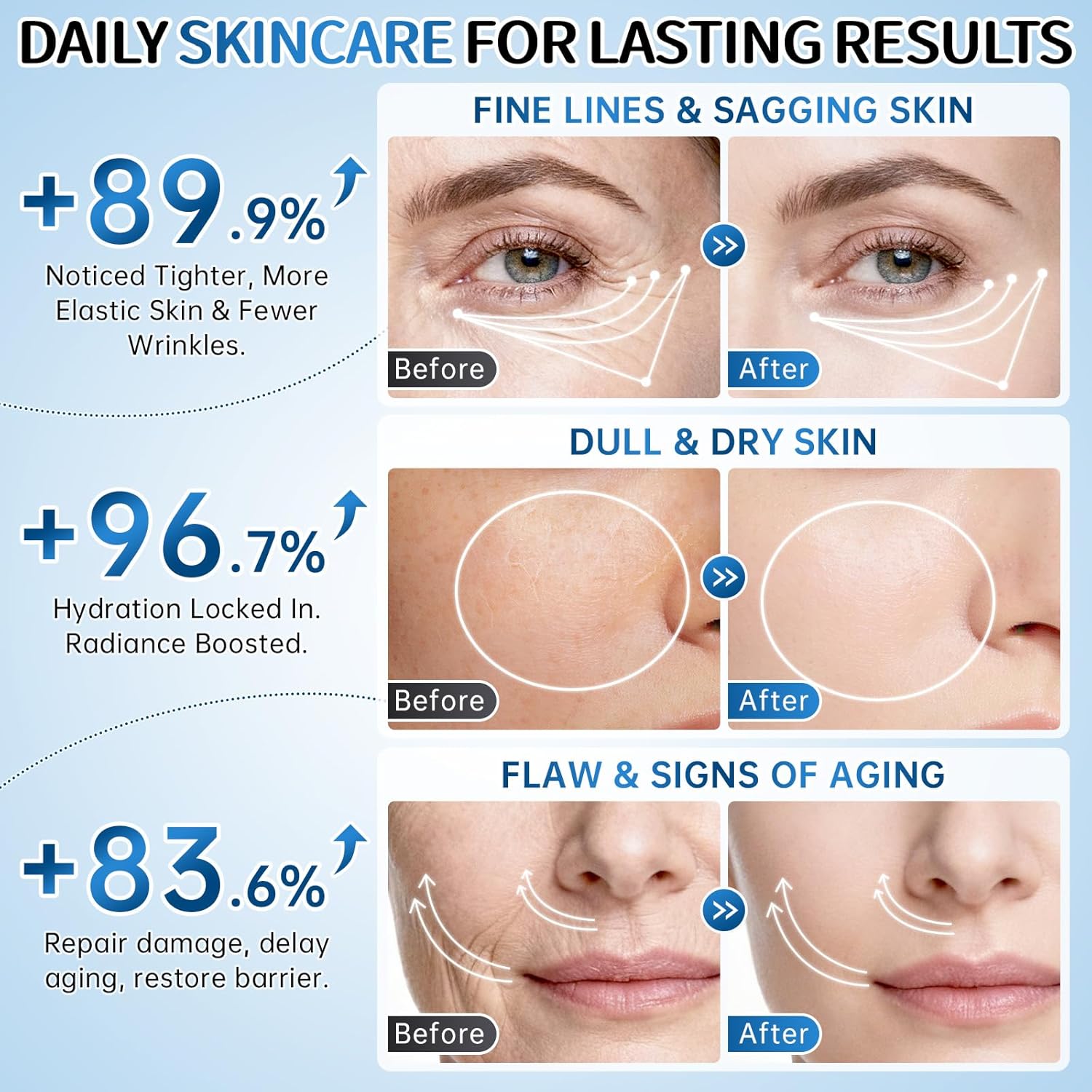 Collagen Skincare Set for Women – 7Pcs Face Care Kit with Cleanser,Toner,Serum,Eye Cream,Face Cream & Masks –