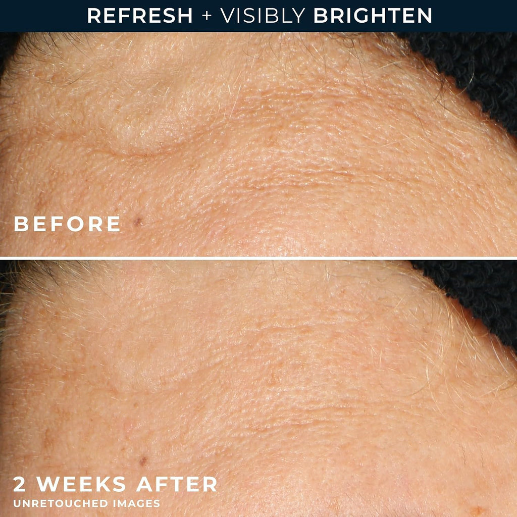 Multi Correxion Revive + Glow Gel Vitamin C Cleanser, Face Wash, Facial Cleanser with Glycolic Acid, Paraben-Free