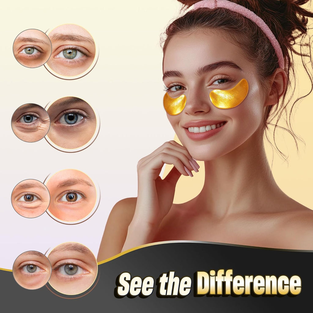 24K Gold Under Eye Patches - 60 Pack for Puffy Eyes, Dark Circles, Bags & Wrinkles with Collagen & Hyaluronic Acid